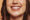 teeth whitening los angeles