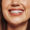 teeth whitening los angeles